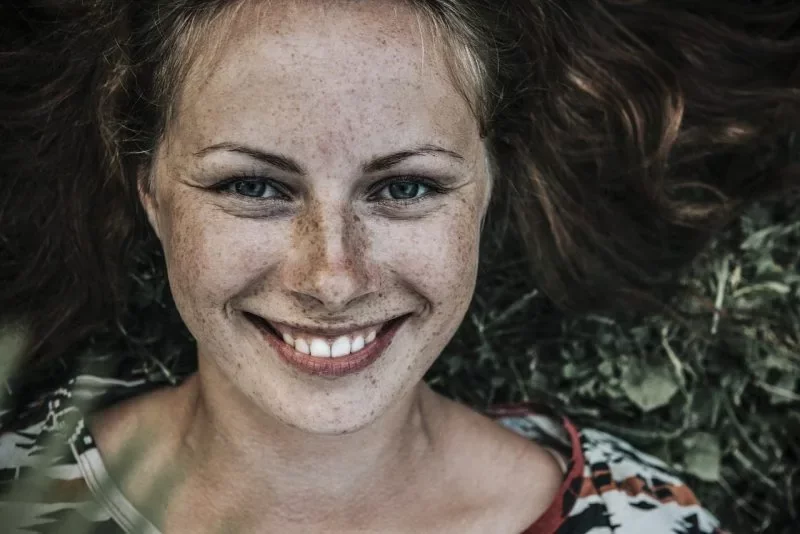 hyper pigmentation et taches de la peau
